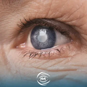 أعراض الزرق في العين